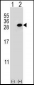 CLTA Antibody (Center)